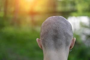 vista posteriore della testa femminile calva su sfondo verde foto