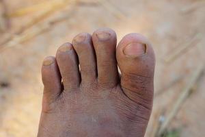 i piedi del contadino erano fangosi e sporchi. foto