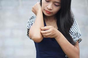 donna che graffia il braccio dal prurito su sfondo grigio chiaro. la causa del prurito della pelle include le punture di insetticoncetto di pelle sanitaria. foto