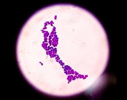 colonia di candida spp sotto visione microscopica. candida albicans. infezione fungina. foto