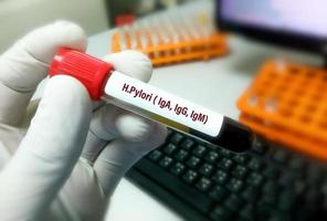 prelievo di sangue per h. pylori iga, igg e igm test, helicobacter pylori foto