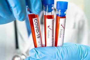 campione di infezione del sangue positivo in provetta per covid-19 coronavirus in laboratorio. scienziato che tiene per controllare e analizzare il paziente in ospedale. foto