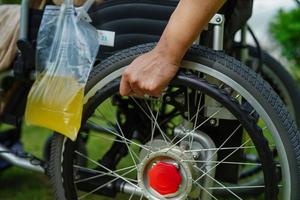 donna asiatica di disabilità con sacchetto di urina sulla sedia a rotelle. foto