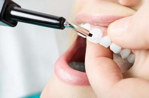 esame di vitalità dei denti. avvicinamento