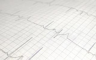 diagramma del cardiogramma con primo piano del tavolo medico, per la registrazione del cuore del chirurgo, messa a fuoco selettiva foto