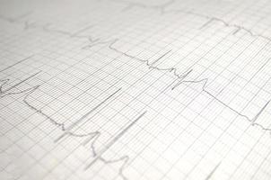 diagramma del cardiogramma con primo piano del tavolo medico, per la registrazione del cuore del chirurgo, messa a fuoco selettiva foto