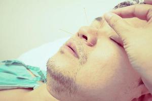foto in stile vintage di un uomo asiatico concentrato e selettivo sta ricevendo un trattamento di agopuntura