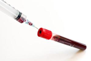 sangue in provetta, coagulo di sangue per esame su sfondo bianco