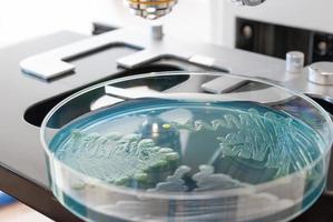 capsula di Petri infettata da batteri e microscopio da laboratorio. foto