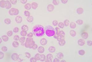 linfociti e banda formano neutrofili