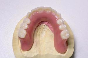 protesi dentale foto