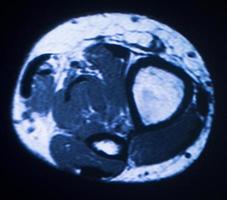 scansione medica per immagini a risonanza magnetica mri