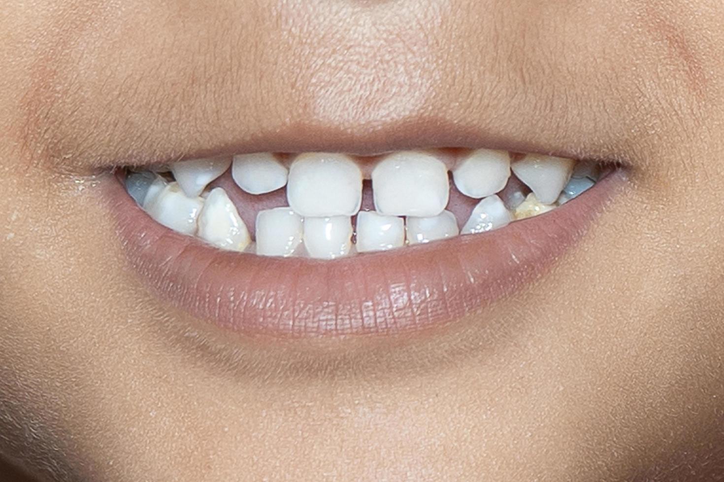 bebê sorria perto. dentes brancos de uma criança isolada foto