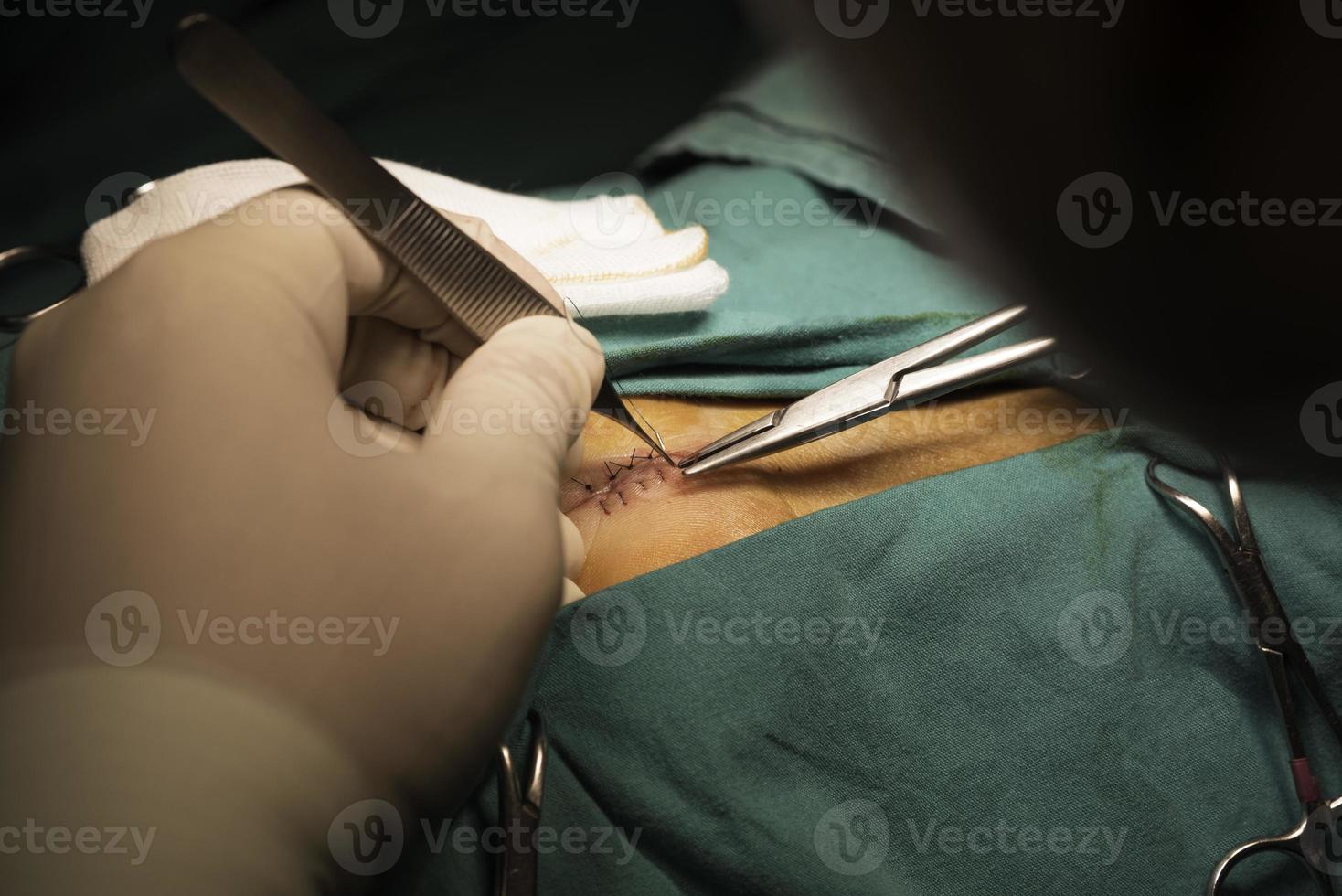 médico suturando a ferida foto