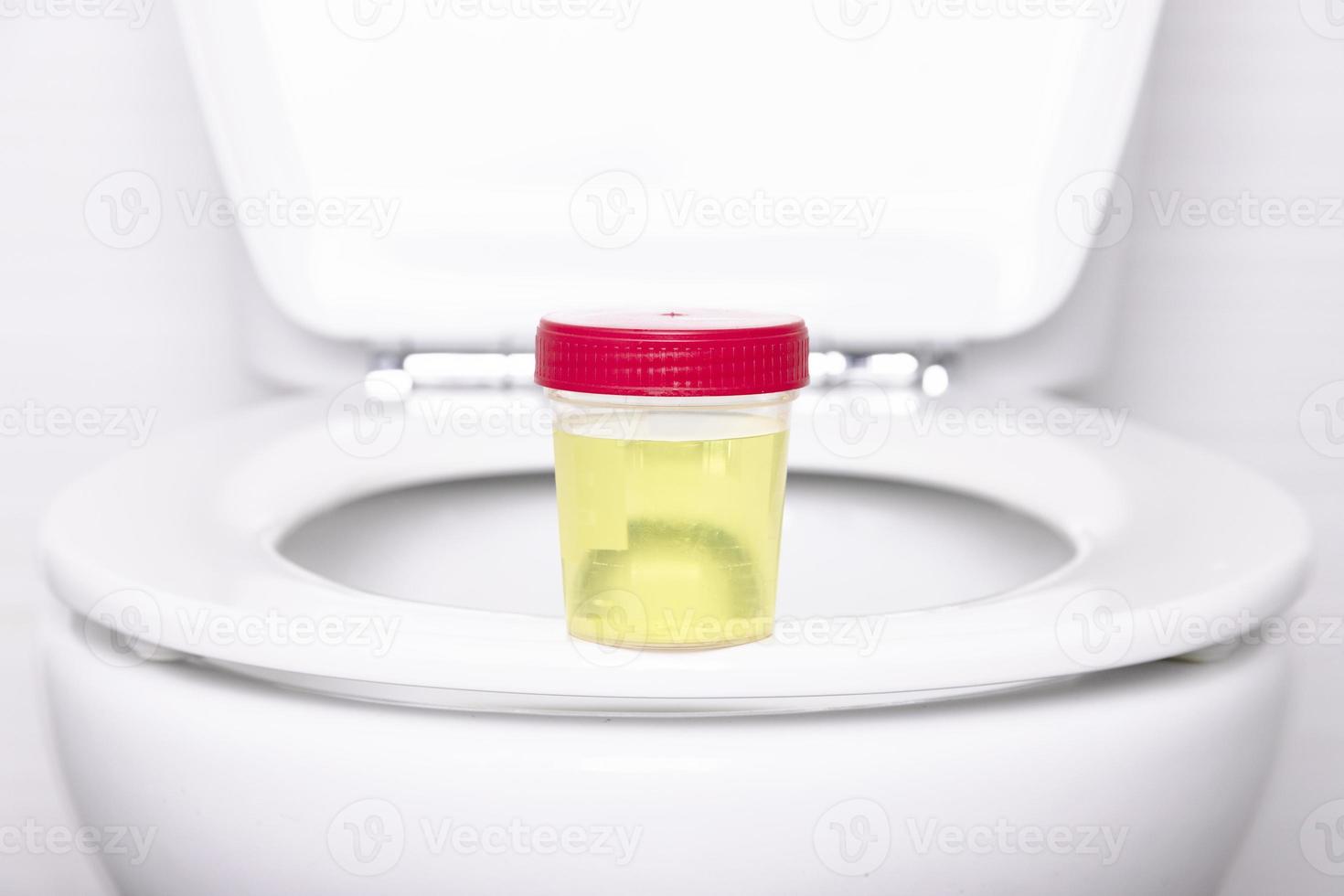 uma amostra de urina em um recipiente médico fica na borda de um banheiro doméstico branco. foco seletivo. foto
