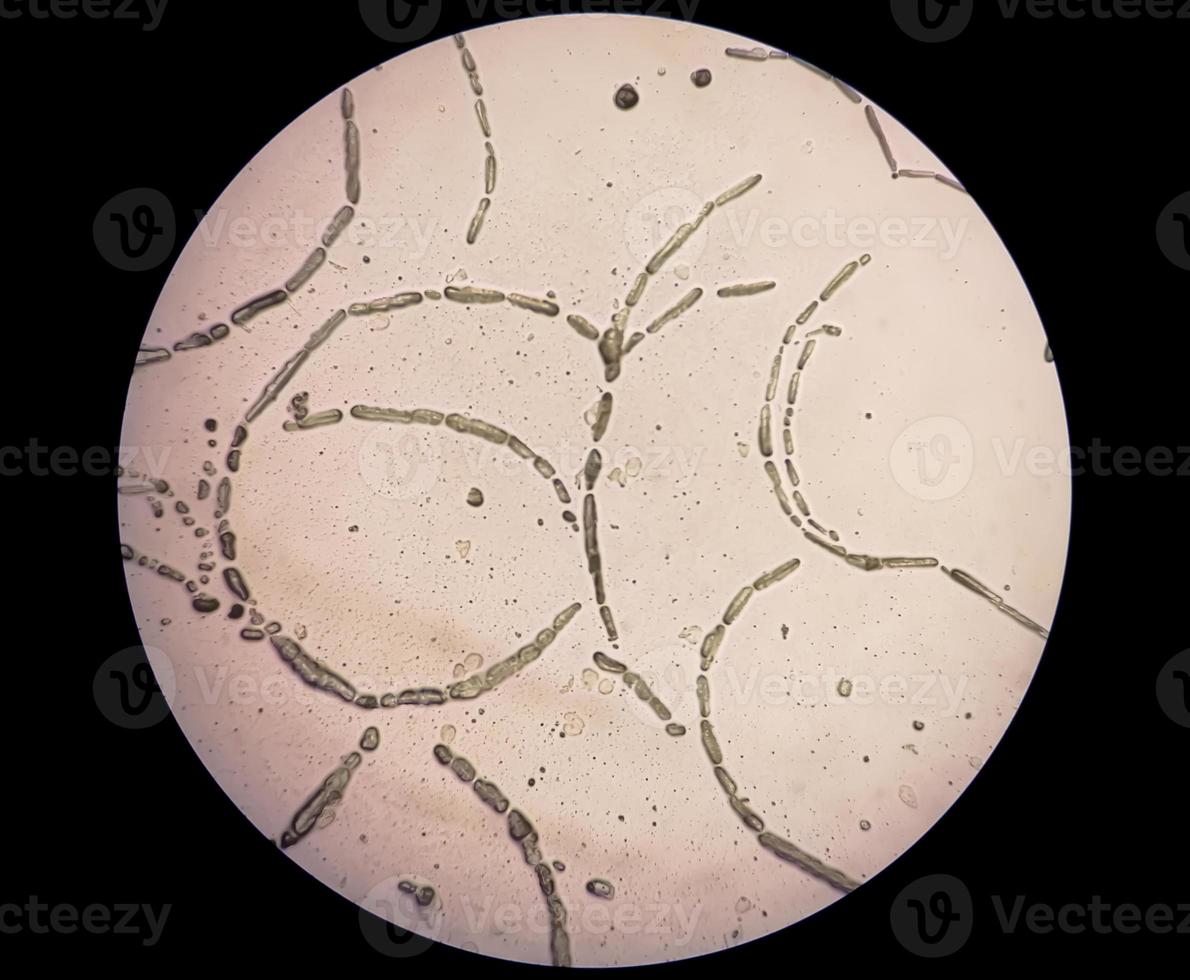 fotomicrografia mostrando hifas de dermatófitos, raspagem de unhas para teste de fungos foto