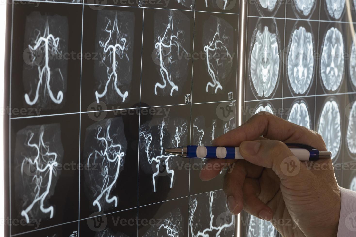médico demonstrando anatomia de ressonância magnética do cérebro foto