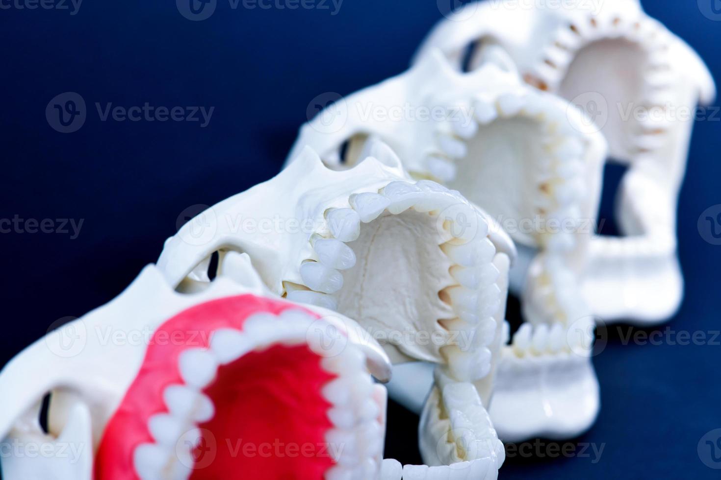 modelos de dentes ortodônticos de dentista foto