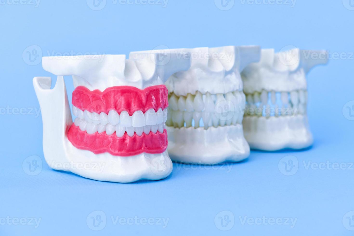 maxilares humanos com modelos de anatomia de dentes e gengivas foto