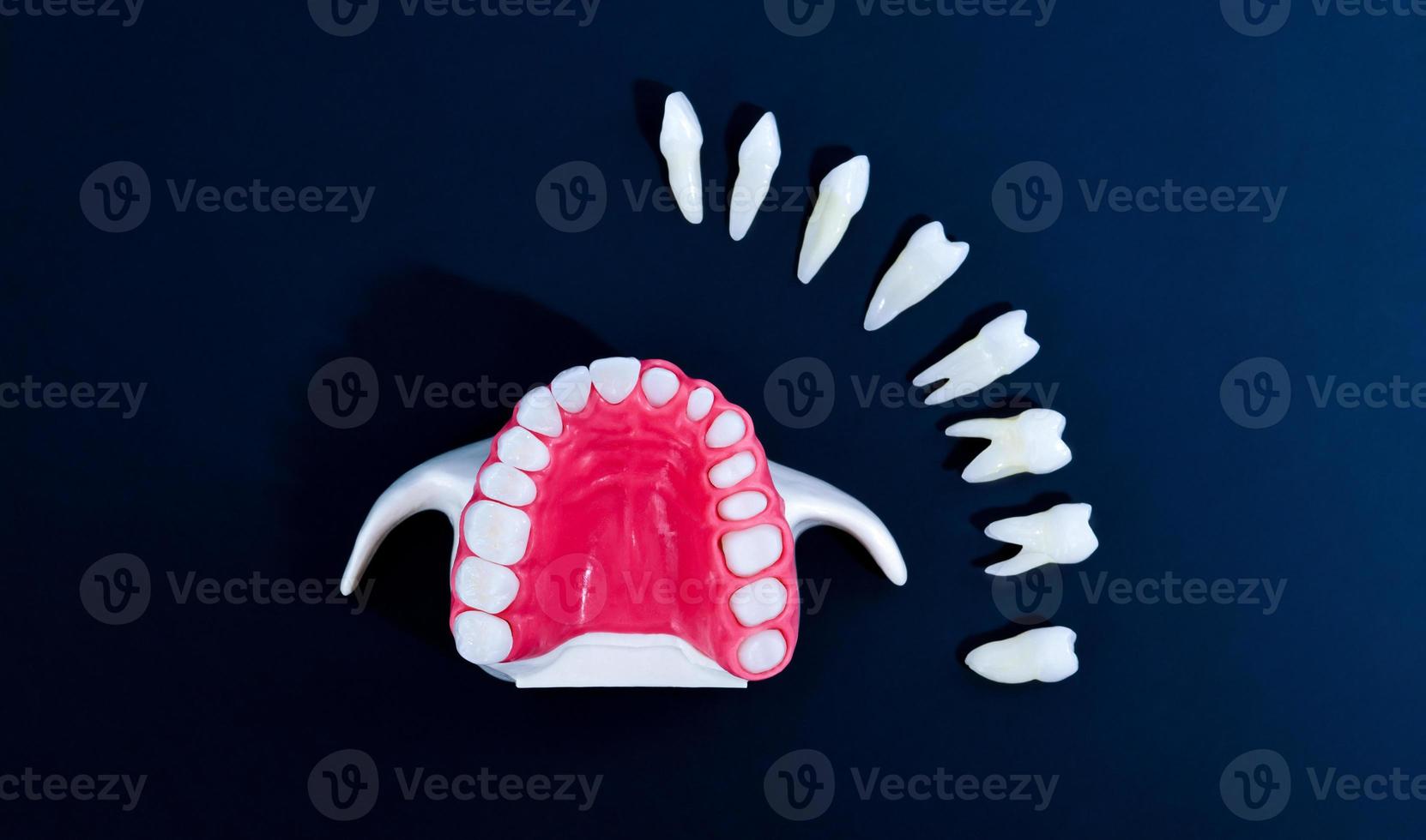 processo de instalação de implante e coroa dentária foto