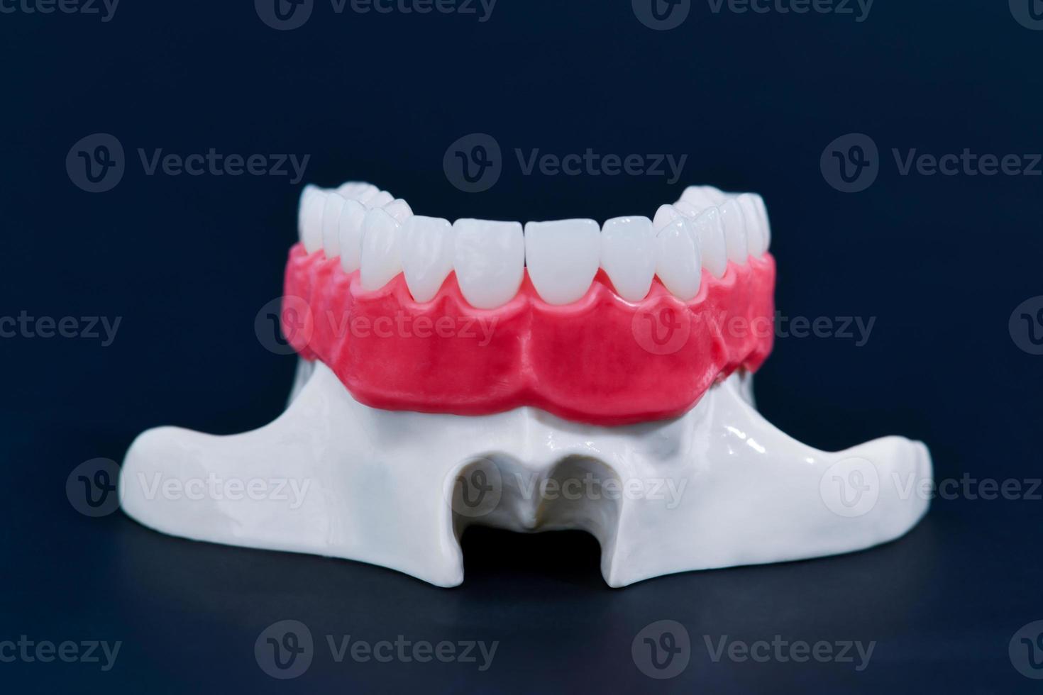 maxilar humano superior com modelo de anatomia de dentes e gengivas foto