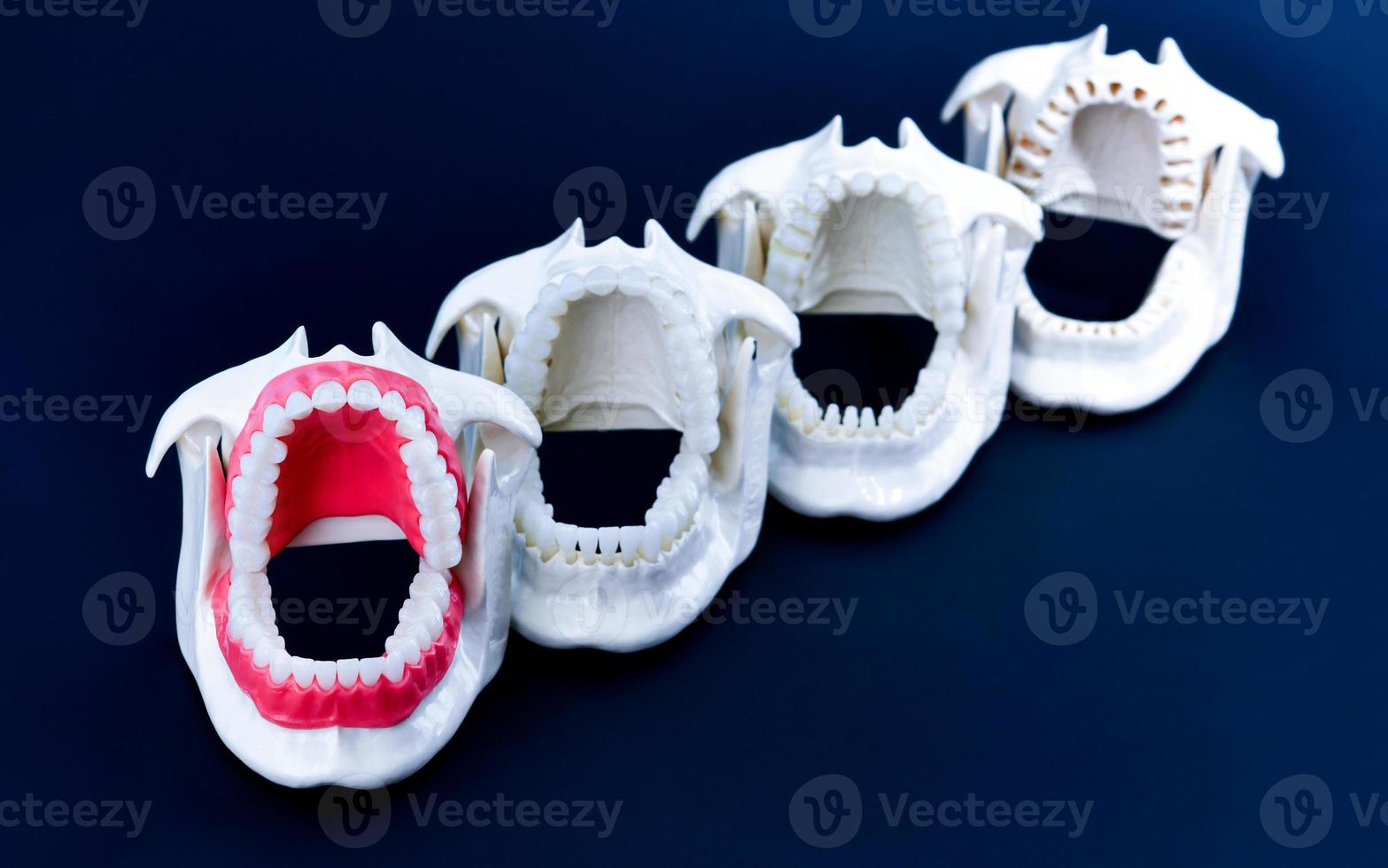 modelos de dentes ortodônticos de dentista foto