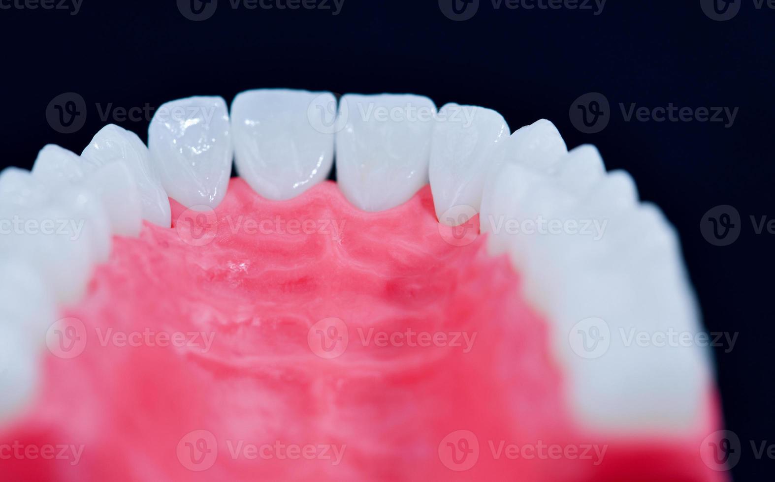 maxilar humano superior com modelo de anatomia de dentes e gengivas foto