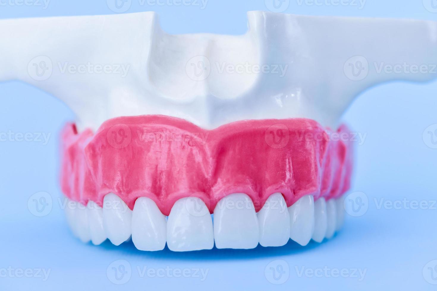 maxilar humano superior com modelo de anatomia de dentes e gengivas foto