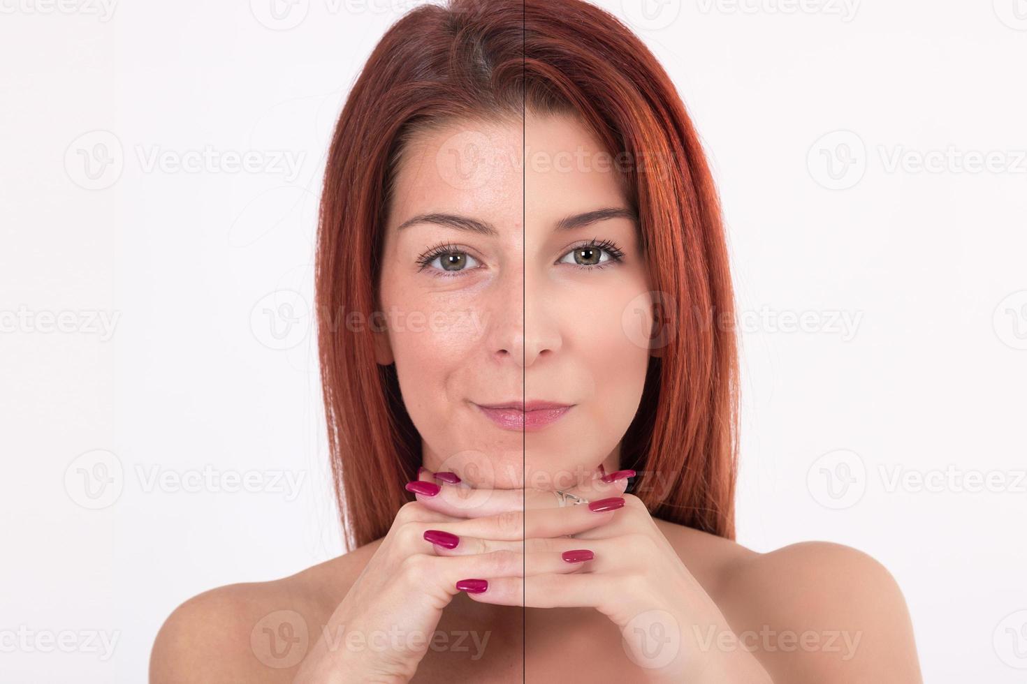 antes e depois do tratamento de beleza. foto