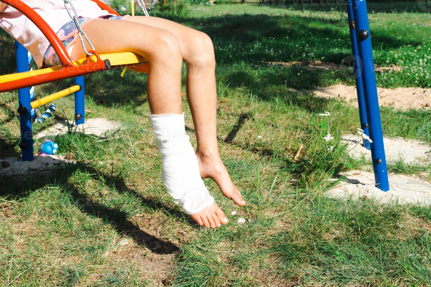 as pernas das crianças são enfaixadas com gesso - com os pés descalços em um balanço. equipamento traumático, lesão infantil, contusão, entorse, fratura foto