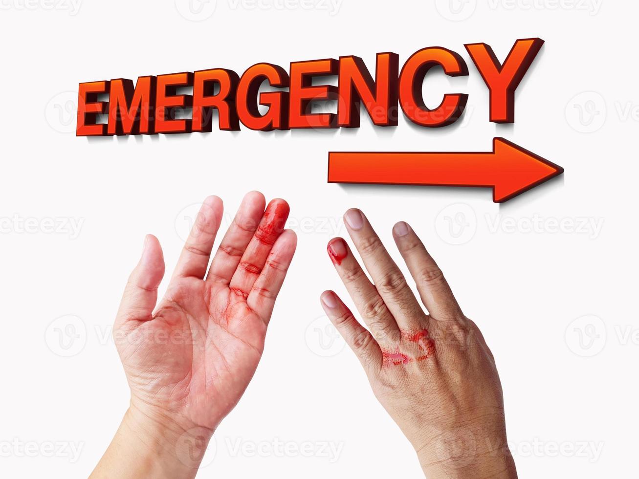 sinal do departamento de emergência mãos sangrentas símbolos de acidente podem acontecer a qualquer momento. foto