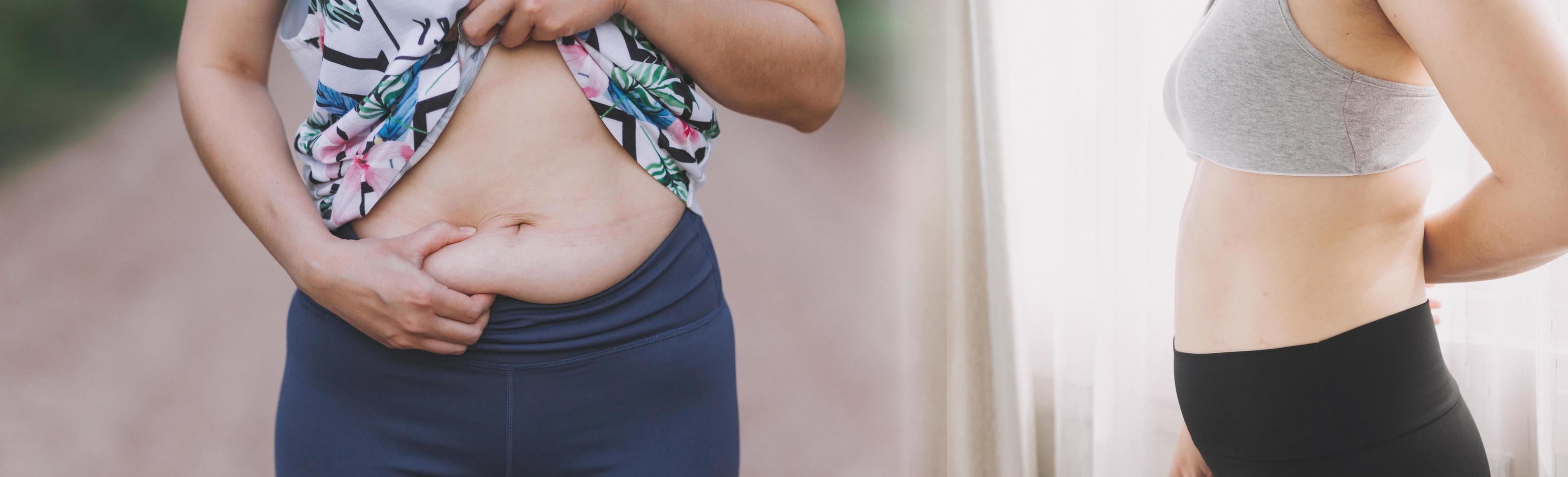 linda mulher gorda com fita métrica ela usa a mão para espremer o excesso de gordura que está isolado em um fundo branco. ela quer perder peso, o conceito de cirurgia e quebrar a gordura sob o foto