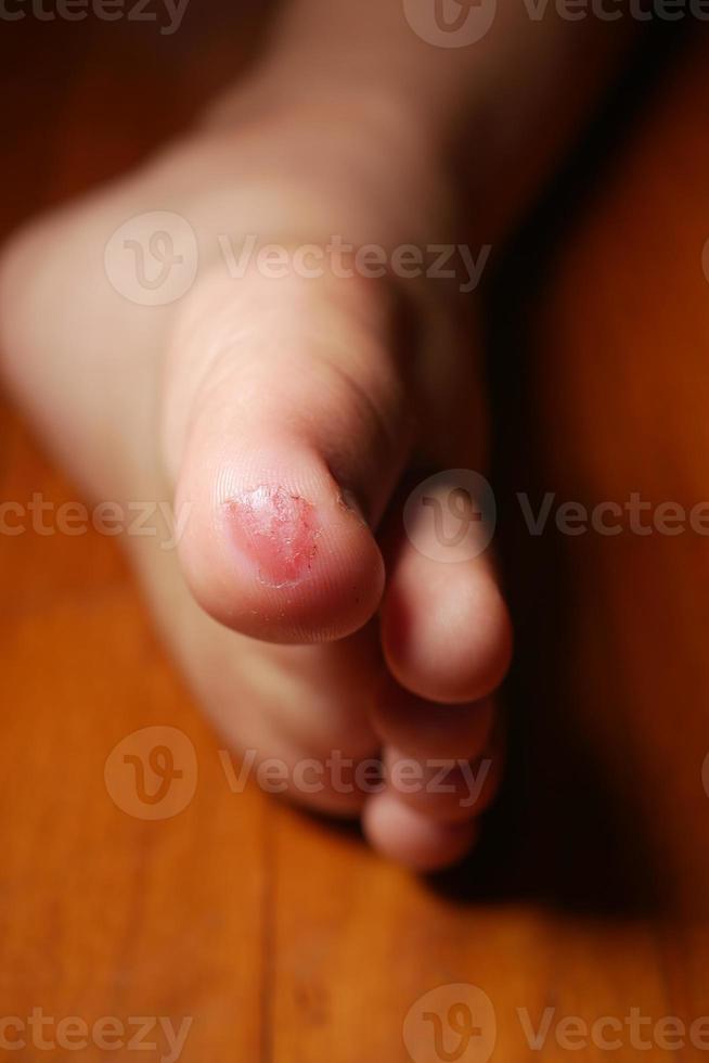 close-up de 5 anos de idade criança ferido pés no chão foto