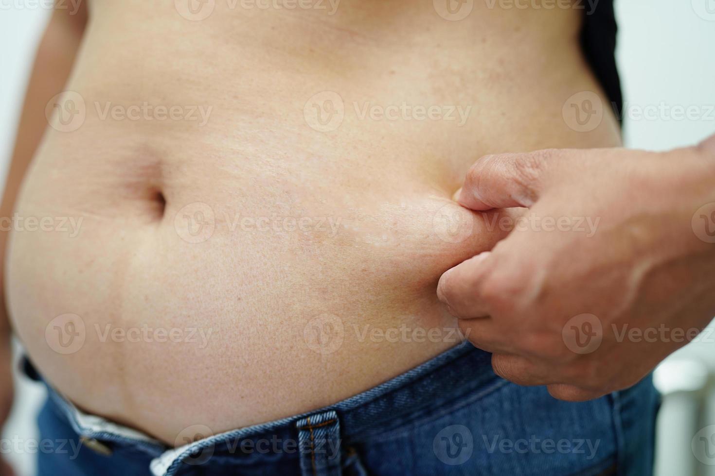a mulher asiática com excesso de peso usa a mão para espremer a barriga gorda, o sobrepeso e a obesidade. foto