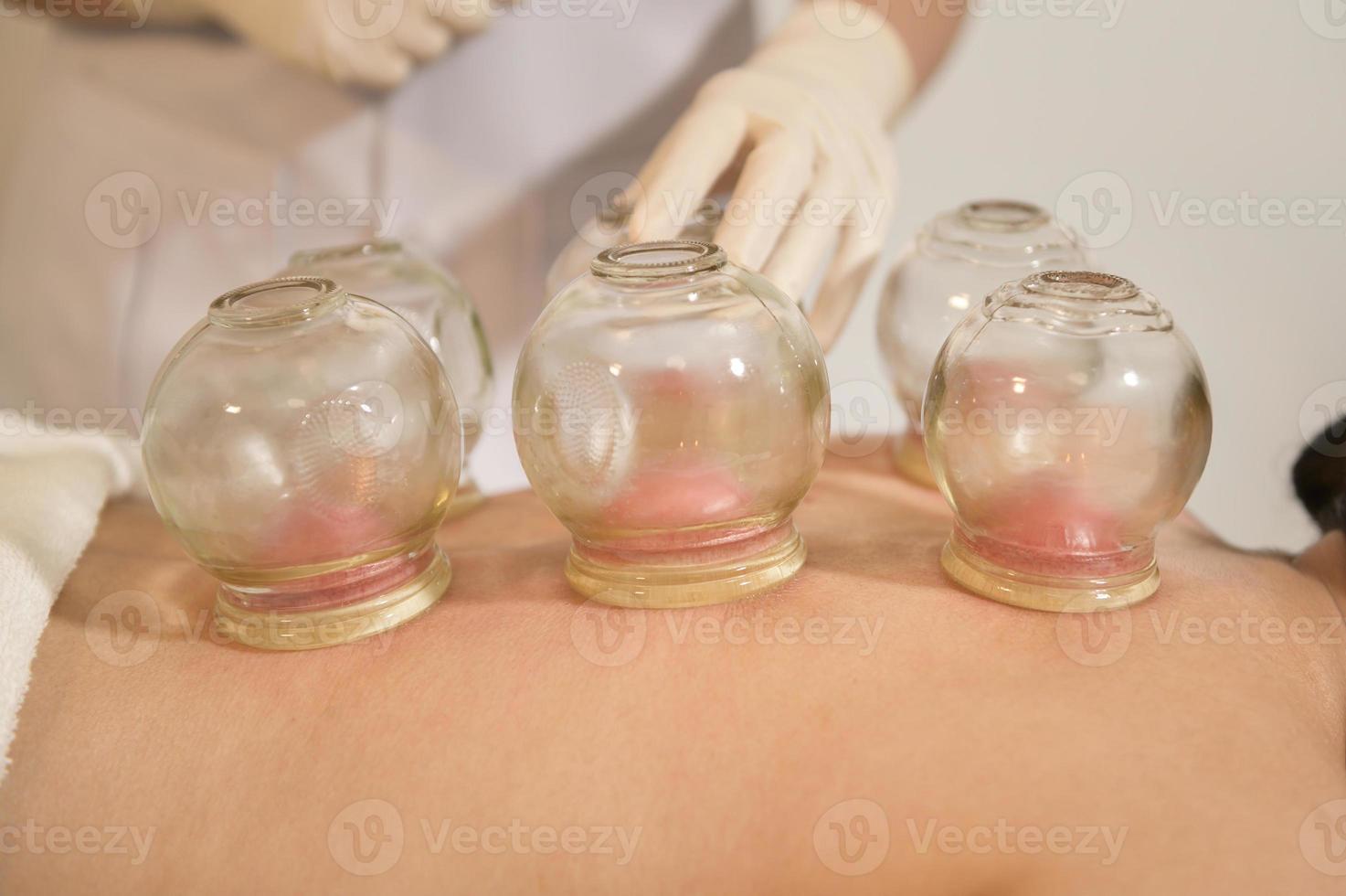 linda mulher recebeu tratamento de ventosa nas costas pelo terapeuta, tratamento de medicina chinesa, conceito de saúde e cura. foto