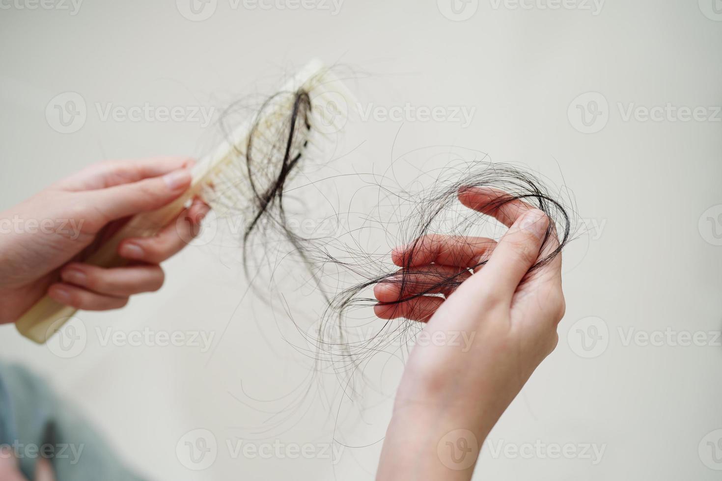 mulher asiática tem problema com perda de cabelo comprido anexado na mão. foto