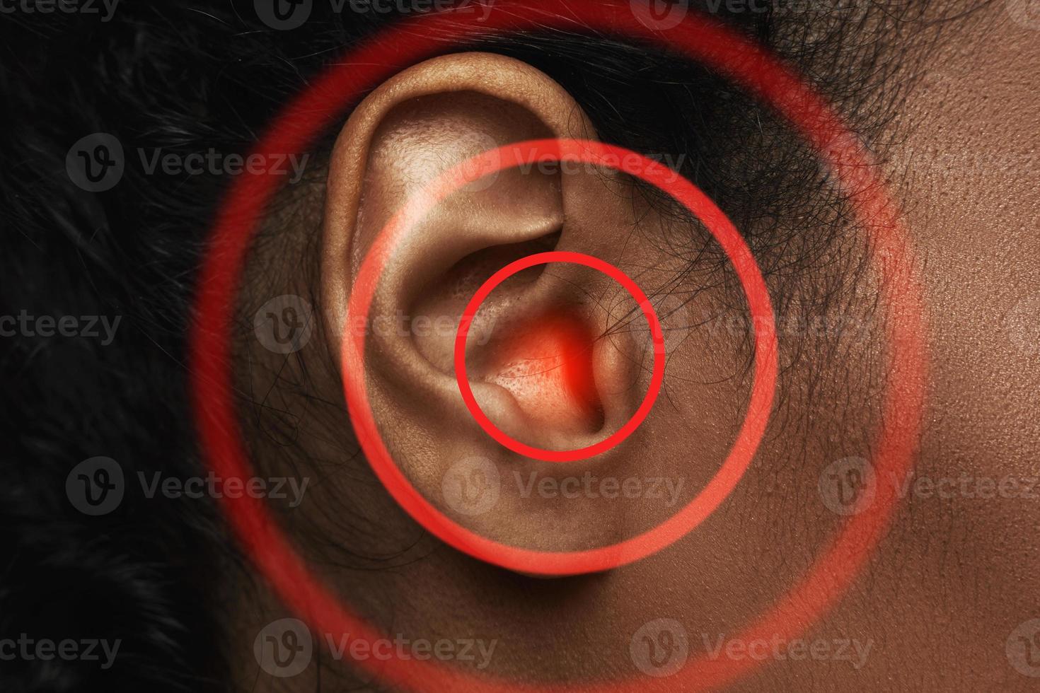 close-up da orelha da mulher negra com fonte de dor foto