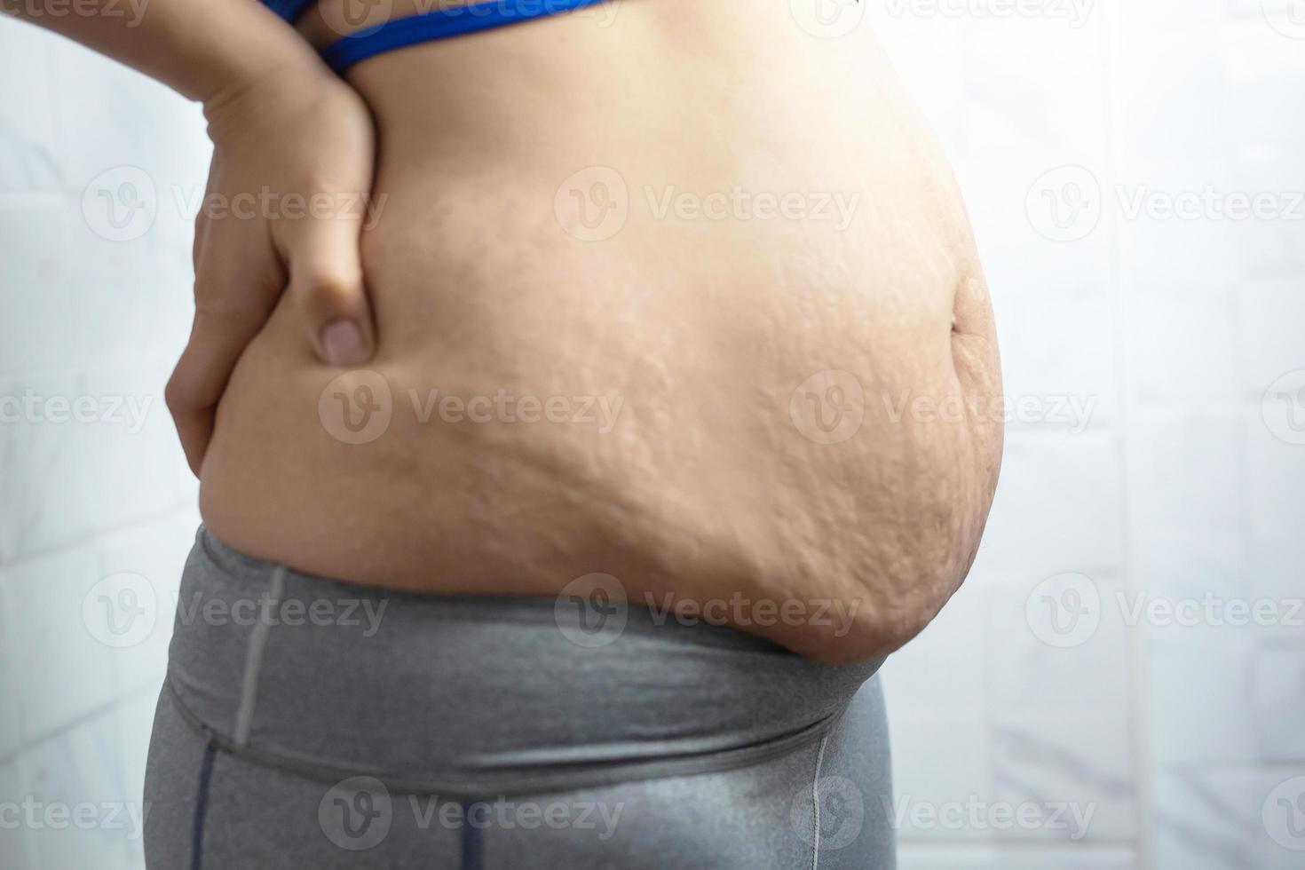 mulher obesa precisa de controle de peso, ela tem excesso de gordura. foto