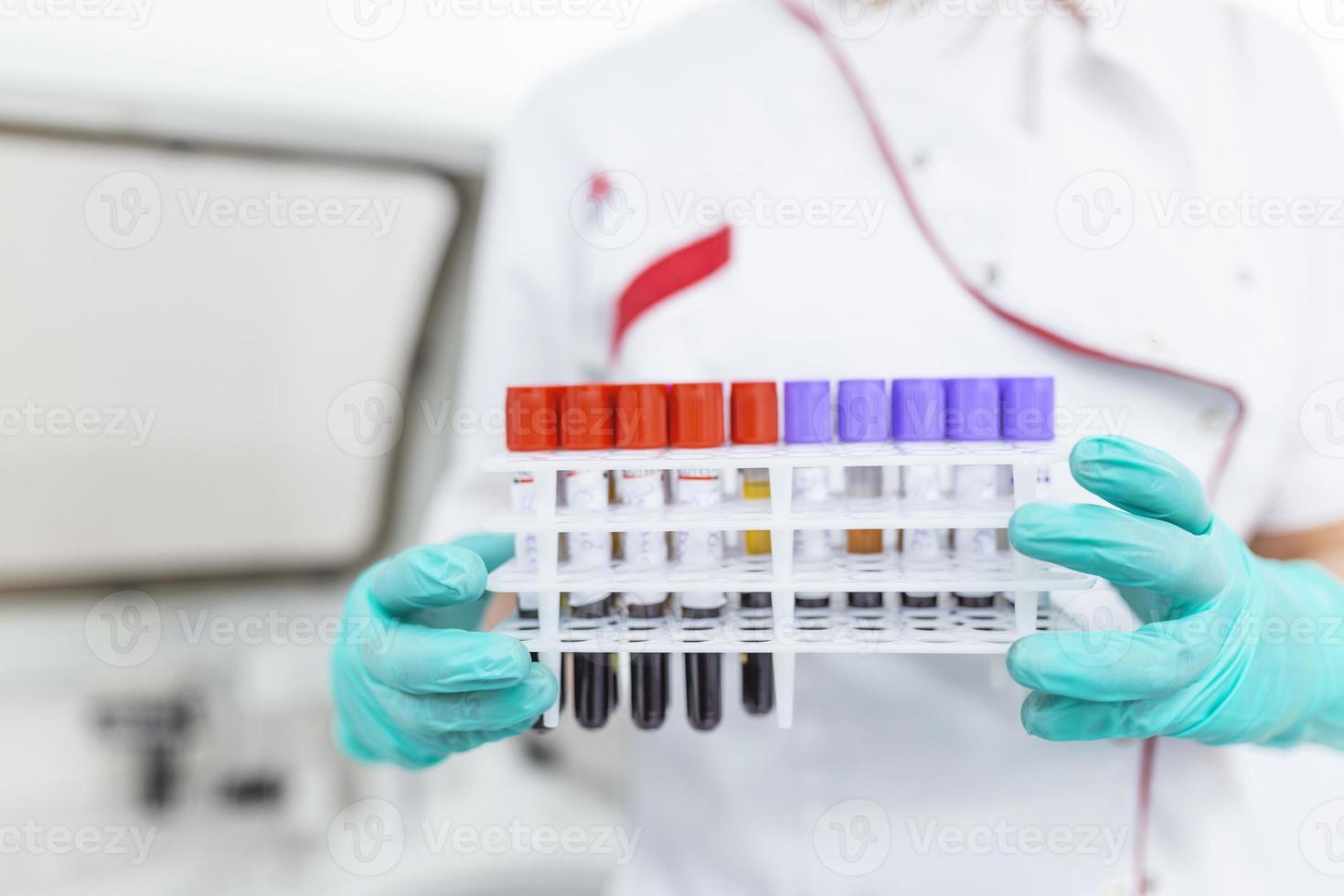 técnico realizando teste de tubo de sangue no laboratório de pesquisa. teste de coronavírus. médico tirando um tubo de amostra de sangue de um rack no laboratório foto