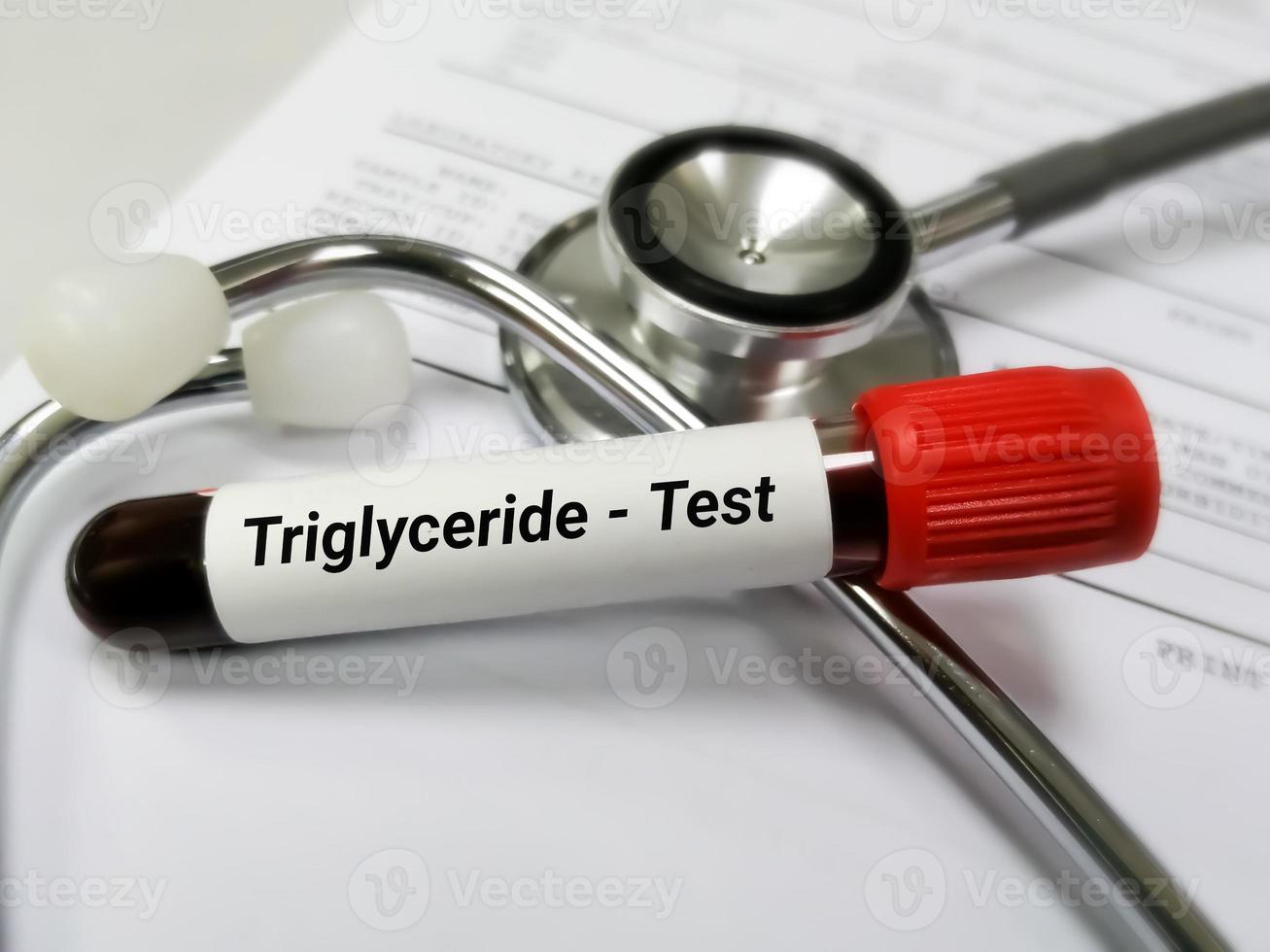 amostra de sangue para teste de triglicerídeos. perfil lipídico. falha cardíaca foto
