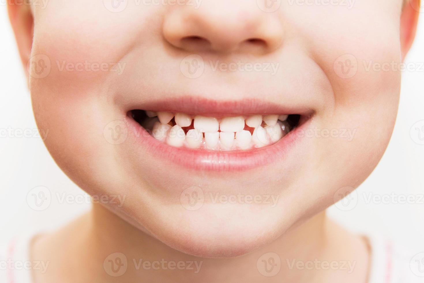 sorriso de bebê perto. dentes de criança em um fundo branco e isolado. foto