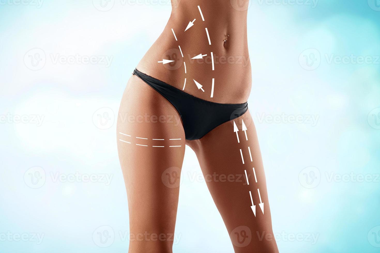 ajuste o corpo feminino com as setas de desenho. cirurgia plástica, nutrição saudável, lipoaspiração, esporte e conceito de remoção de celulite. foto