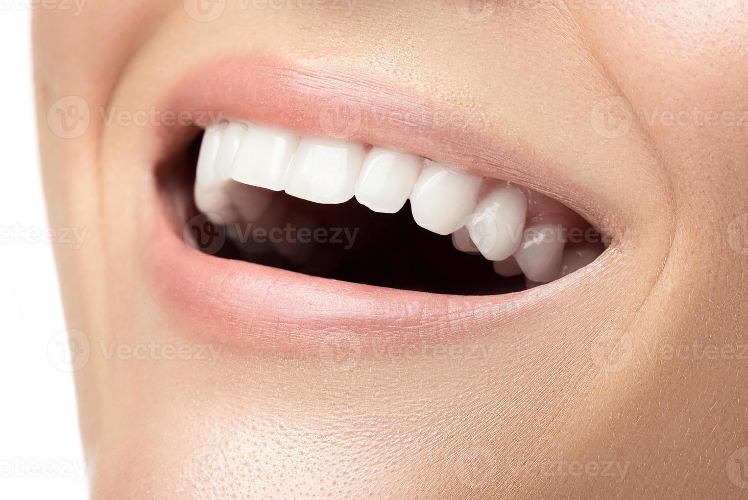 boca feminina com dentes brancos lindos foto
