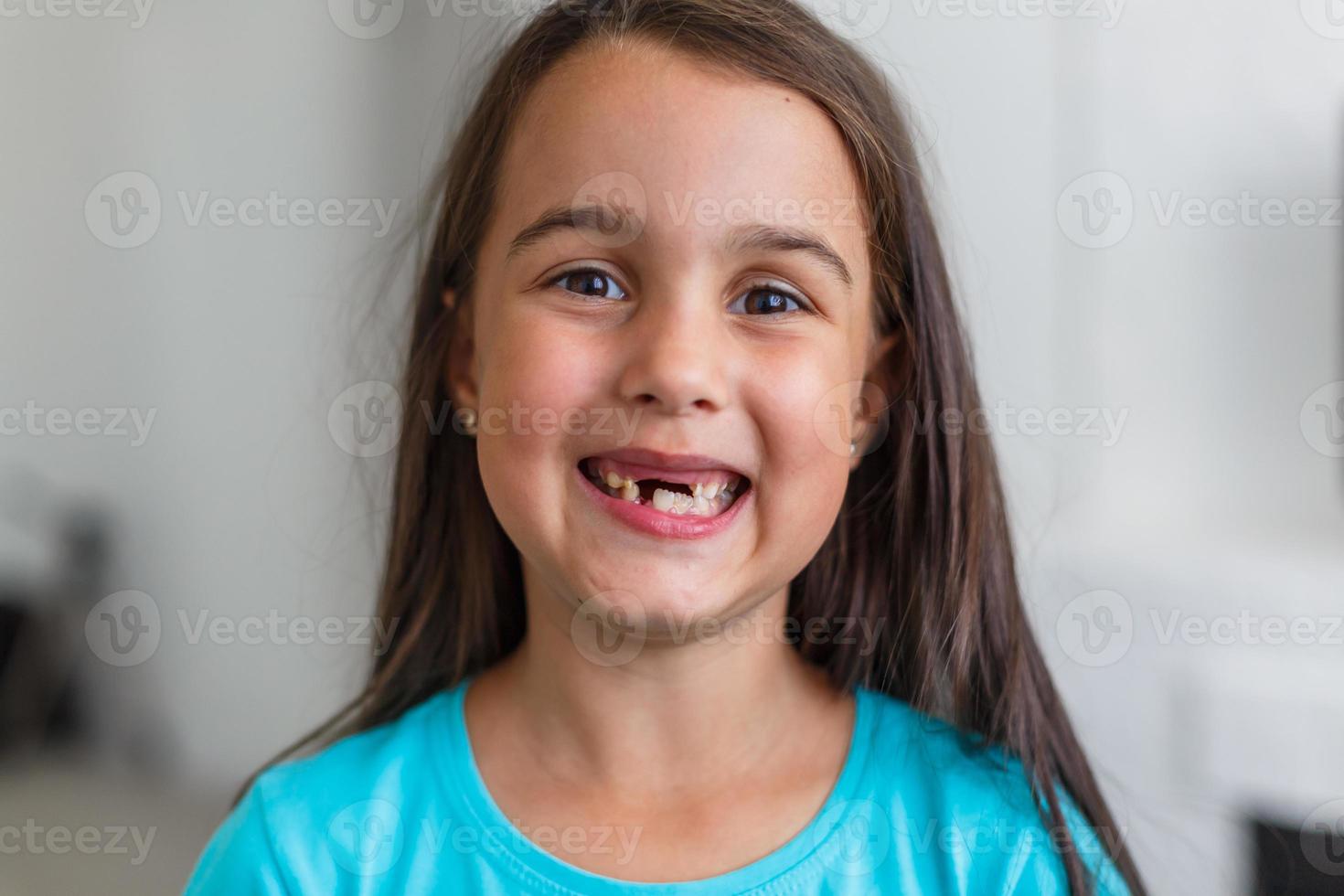menina primeiro dente faltando em um fundo branco foto