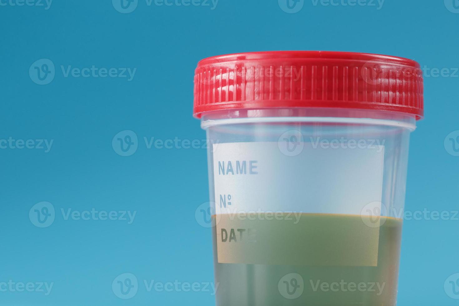 urina em um recipiente de teste com tampa vermelha sobre fundo azul. cuidados de saúde e conceito médico. foto