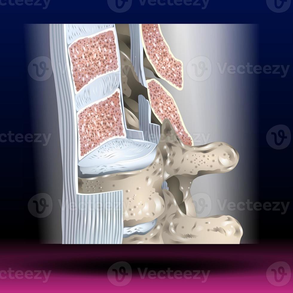 ligamento longitudinal anterior - partes do corpo - coluna vertebral foto