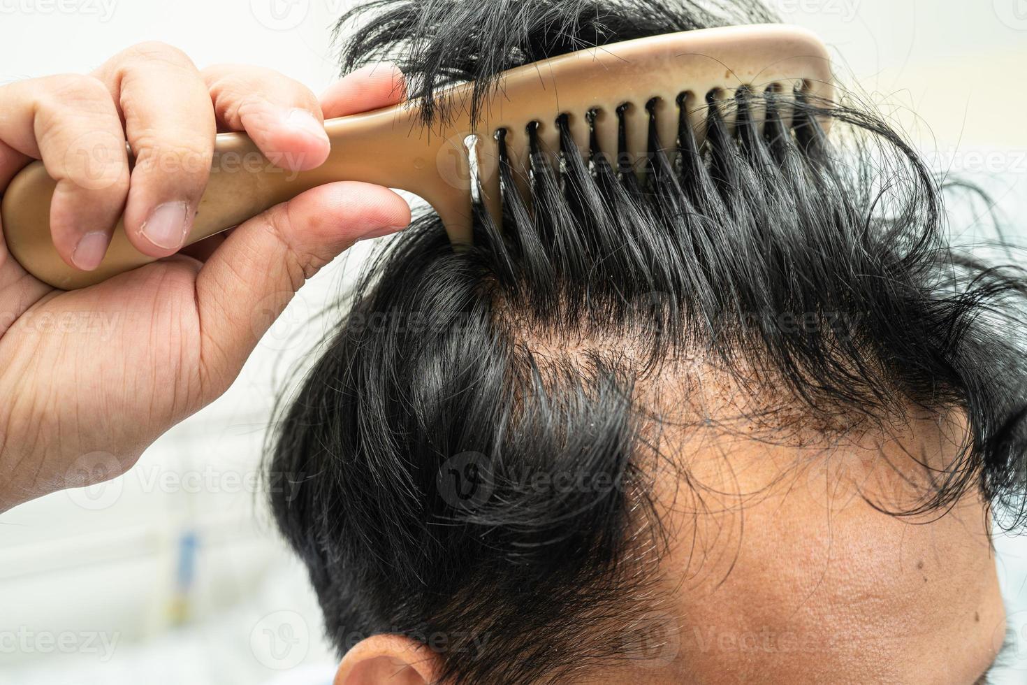 Careca às frente do cabeça e início não perda cabelo glabro do maduro ásia o negócio inteligente ativo escritório cara. foto