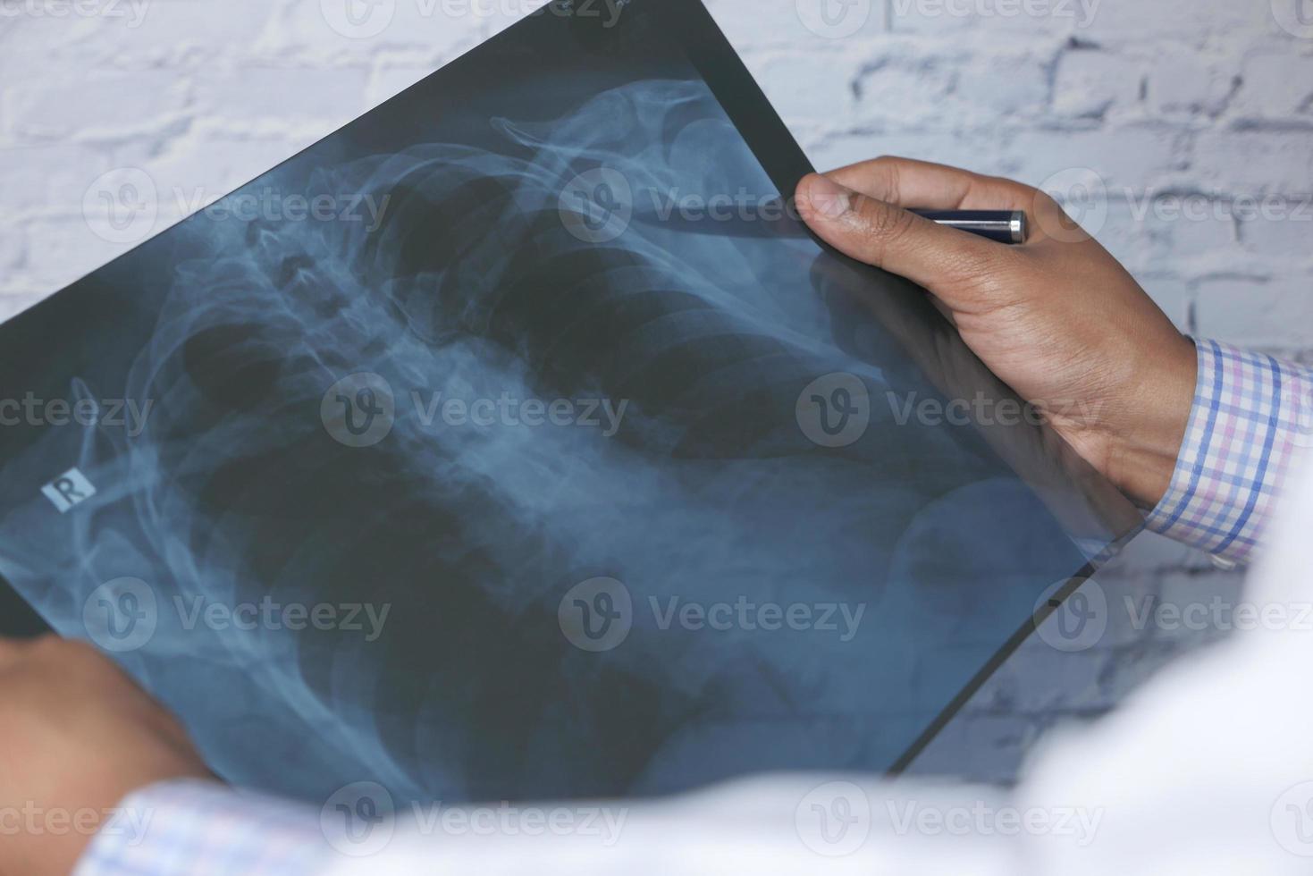 médico analisando raios-x closeup foto