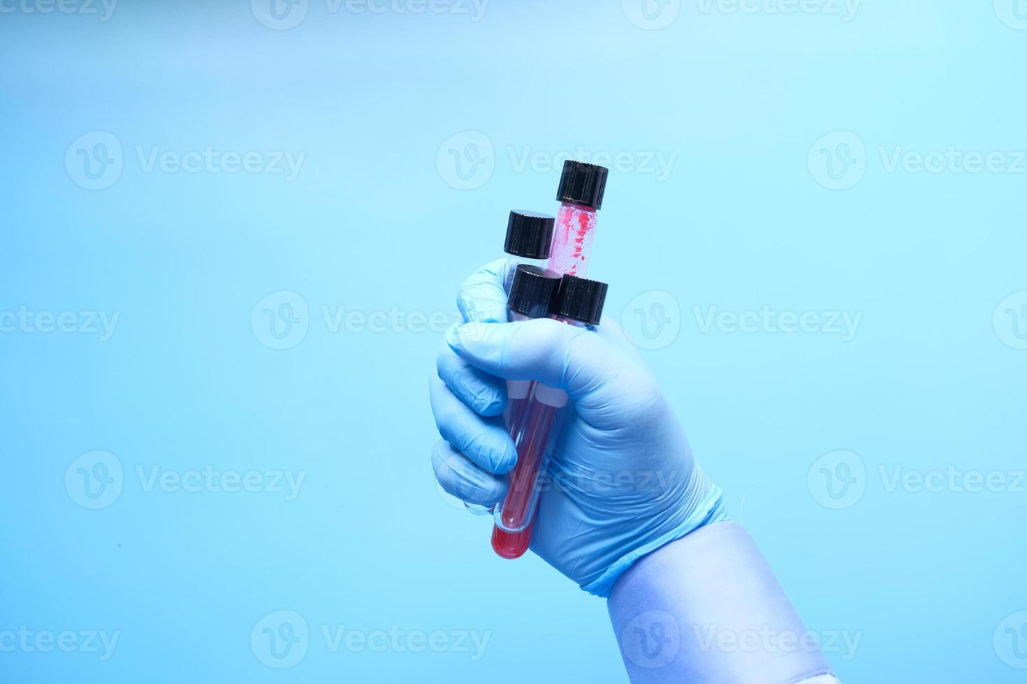 mão usando luva médica azul segurando 3 tubos de ensaio foto