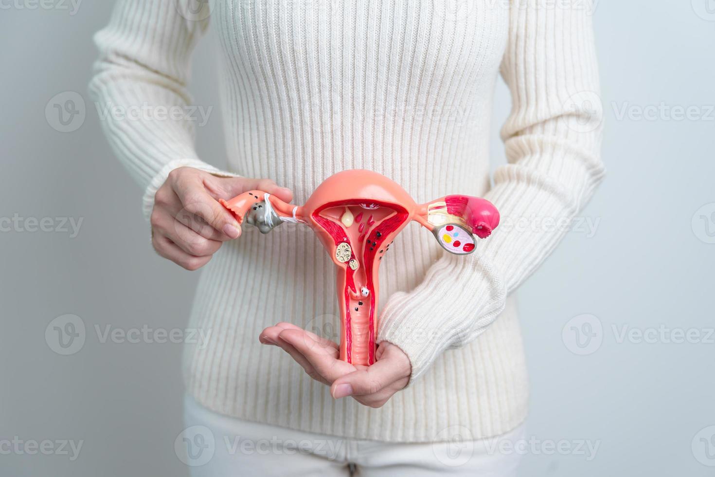 mulher segurando modelo de útero e ovários. câncer de ovário e cervical, distúrbio do colo do útero, endometriose, histerectomia, miomas uterinos, sistema reprodutivo e conceito de gravidez foto
